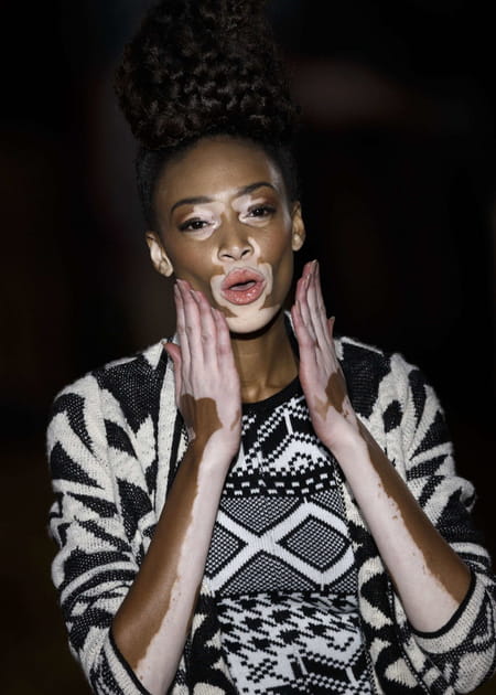 Chantelle Winnie, ambassadrice de la diff&eacute;rence